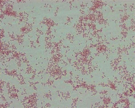 B Abortus S99 Strain Stained With Gram S Staining And Observed Under Download Scientific