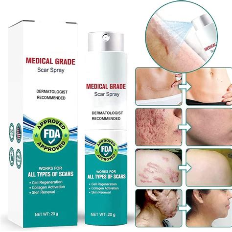 South Moon Medical Grade Scar Spray Advanced Scar Removal Treatment