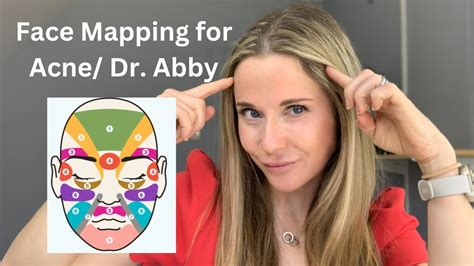 Face Mapping For Acne The Location Of Your Breakouts Can Tell You A Lot Dr Abby Youtube