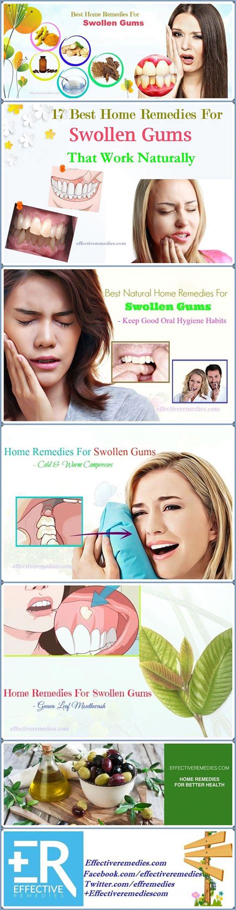 17 Best Home Remedies For Swollen Gums That Work Naturally Swollen