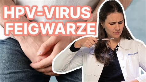 Feigwarzen Humanes Papillomavirus Hpv Dr Med Alice Martin Youtube