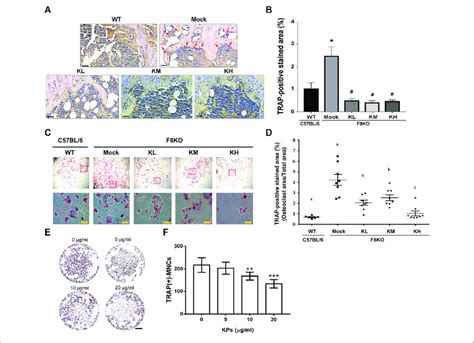 Effects Of KP Treatment On Osteoclast Differentiation A TRAP