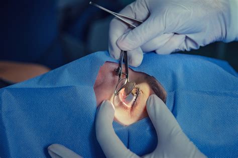 Cirurgia De Glaucoma Entenda Tudo Sobre O Assunto Holhos