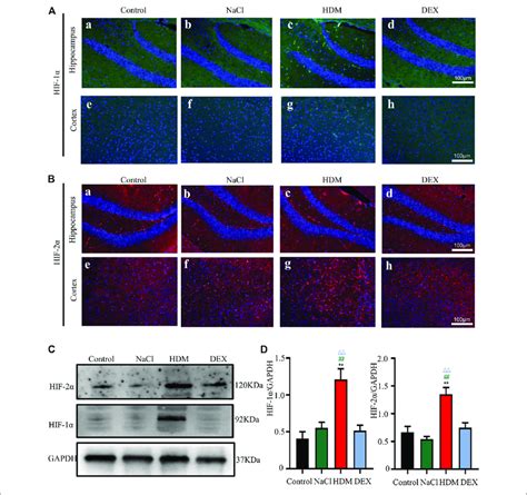 The Expression Of Hif And Hif In The Brain Was Increased In The