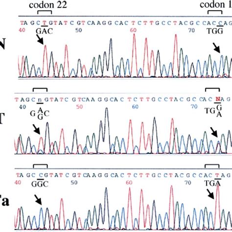 Detection Of Point Mutations Of The K Ras Gene By Pcr Sscp Analysis N