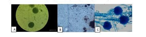 Microscopic Examination Of Aspergillus Fumigatus A Aspergillus