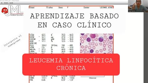 LEUCEMIA LINFOCÍTICA CRÓNICA APRENDIZAJE BASADO EN CASO CLÍNICO