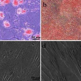 Adipogenic And Osteogenic Differentiation Of Hucm Stem Cells Were