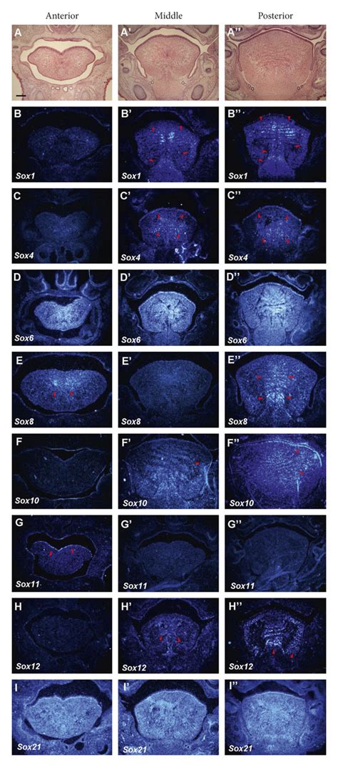 Expression Of Sox Genes In Tongue Development At E18 Frontal Sections