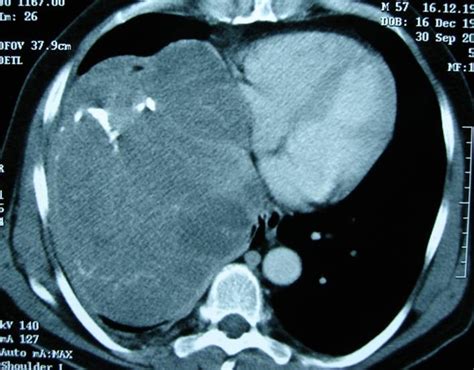 Pneumologie unsere Krankheitsbilder im Röntgenbild