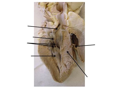 Sheep Heart Images