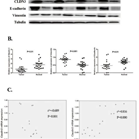 Reduced Cldn3 Expression In Lung Sqcc Tissues And Association With The