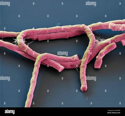 Las Bacterias De ántrax Color Análisis Micrografía De Electrones Sem