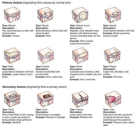 Macules Vs Papules Primary Lesions Pediatrics Pinterest Medical