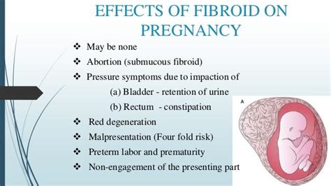 Fibroid complicating pregnancy