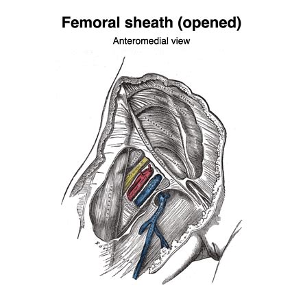 Femoral Sheath