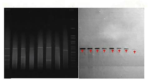 S Pfge And Southern Hybridisation Of A Portion Of Cr Hvkp Strains In