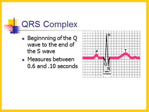 How To Measure The Qrs Complex