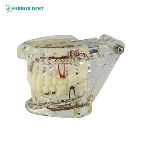 Dental Orthodontic Teeth Model With Braces Archwire Gum Tooth Resin