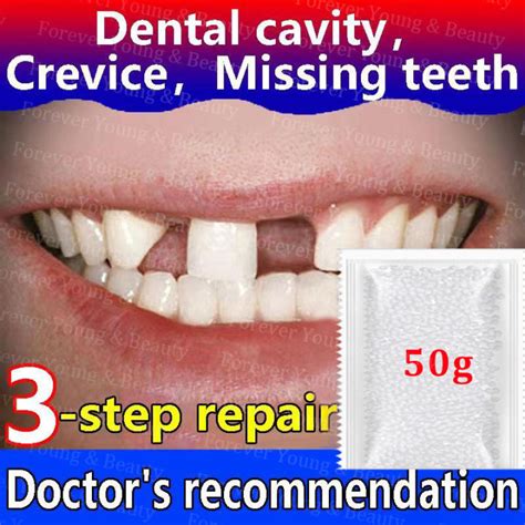 Diy Tooth Repair Kit Temporary Tooth Repair Kit 50g Artificial