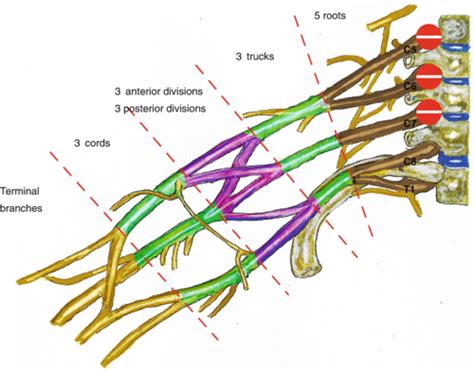 Msk Upper Limb Trama Flashcards Quizlet