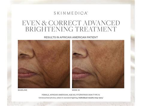 SkinMedica Even Correct Advanced Brightening Treatment Serum LovelySkin