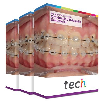 M Ster T Tulo Propio En Ortodoncia Y Ortopedia Dentofacial Tech Espa A