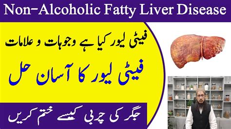 Fatty Liver Treatment Urdu Hindi Jigar Ki Charbi Ka Ilaj Fatty Liver