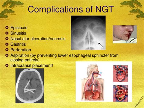 Ppt Gastric Resection General Surgical And Anesthetic Considerations