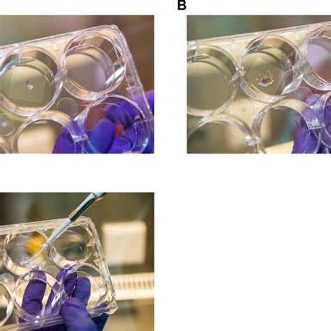 Optimized Protocol For Smfish On Whole Human Organoids A