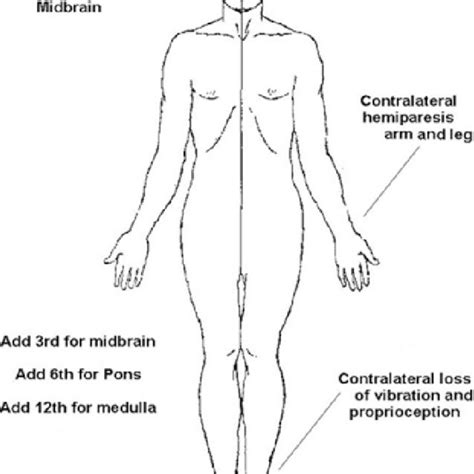 (PDF) The rule of 4 of the brainstem: A simplified method for ...