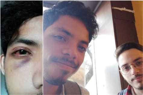 TERRIBLE En Argentina 7 Sujetos Persiguieron Y Atacaron A Una Pareja Gay Uno De Los Agredidos