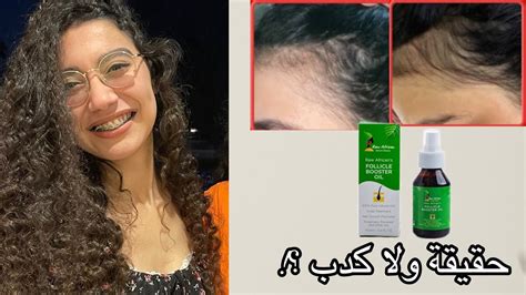 Raw African follicle booster hair oil زيت رو افريكان لانبات و تطويل