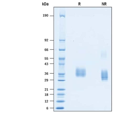 R D Systems Recombinant SARS CoV 2 Spike RBD His Tag Protein CF