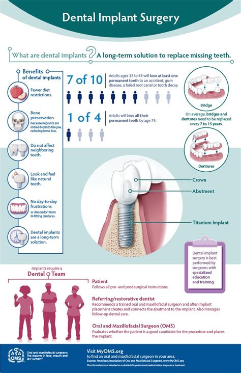 Dental Implant Surgery Explained