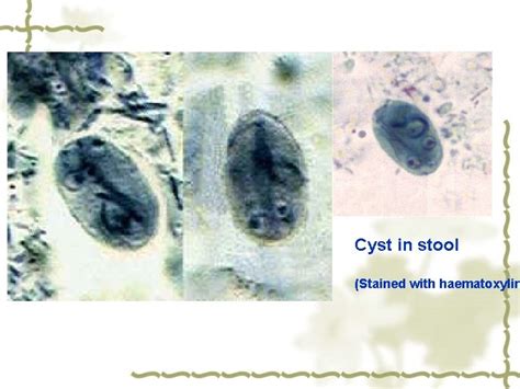 Giardia Lamblia Intestinal Flagellate Giardia Lambilia Lives In