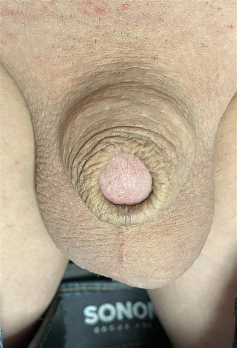Tiny Micro Cock Nude Pics XHamster