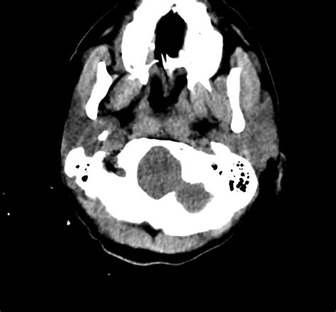 A Systematic Approach to the Interpretation of CT Head