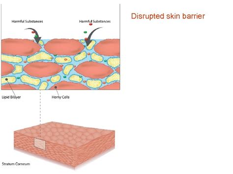 Stratum Corneum How Does Your Body Keep