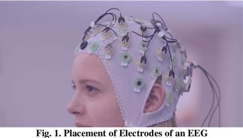 Figure 1 From Computer Aided Diagnosis Of ASD Based On EEG Using