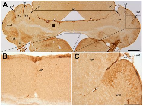 Transverse Section Through The Anterior Lobe Of The Nax Cerebellum At