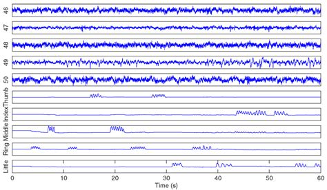 Frontiers Decoding Finger Flexion From Band Specific Ecog Signals In