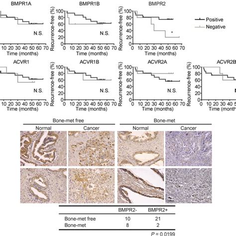 The Expression Of BMPR2 Receptor Is Inversely Correlated With