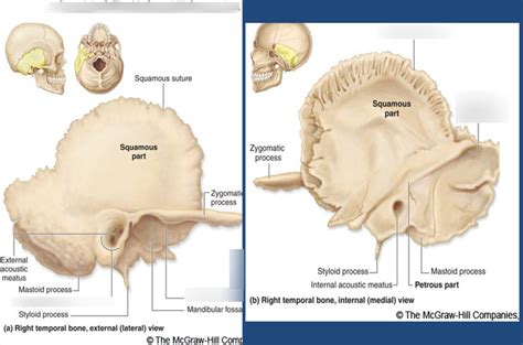 Axial System Temporal Bone Diagram Quizlet