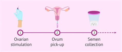 What Is In Vitro Fertilization IVF Process Cost Success Rates