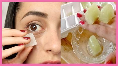 Elimina Ojeras Y Bolsas De Ojos Con ESTE Remedio Casero YouTube