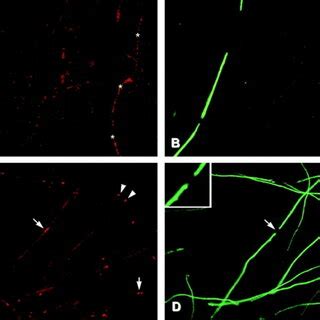 Immunoblot And Northern Analysis Of Contactin And Caspr Expression A