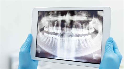 Radiography Course Information Nebdn Dental Radiography