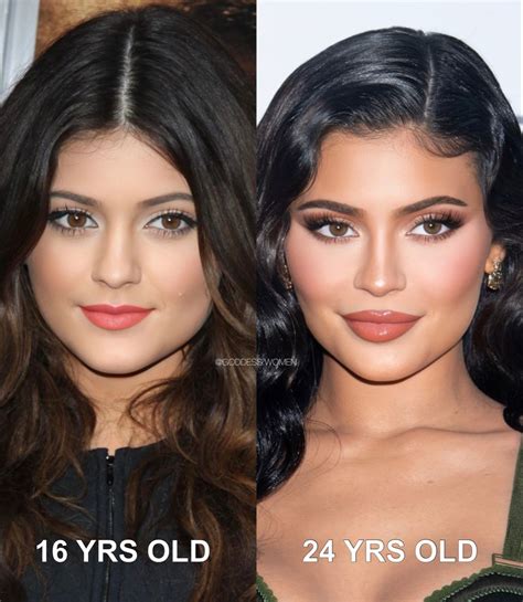 Kylie Jenner Plastic Surgery Before And After Images The Teal Mango Artofit