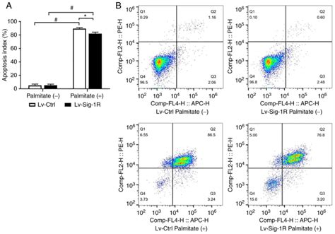 Sigma‑1 Receptor Overexpression Promotes Proliferation And Ameliorates